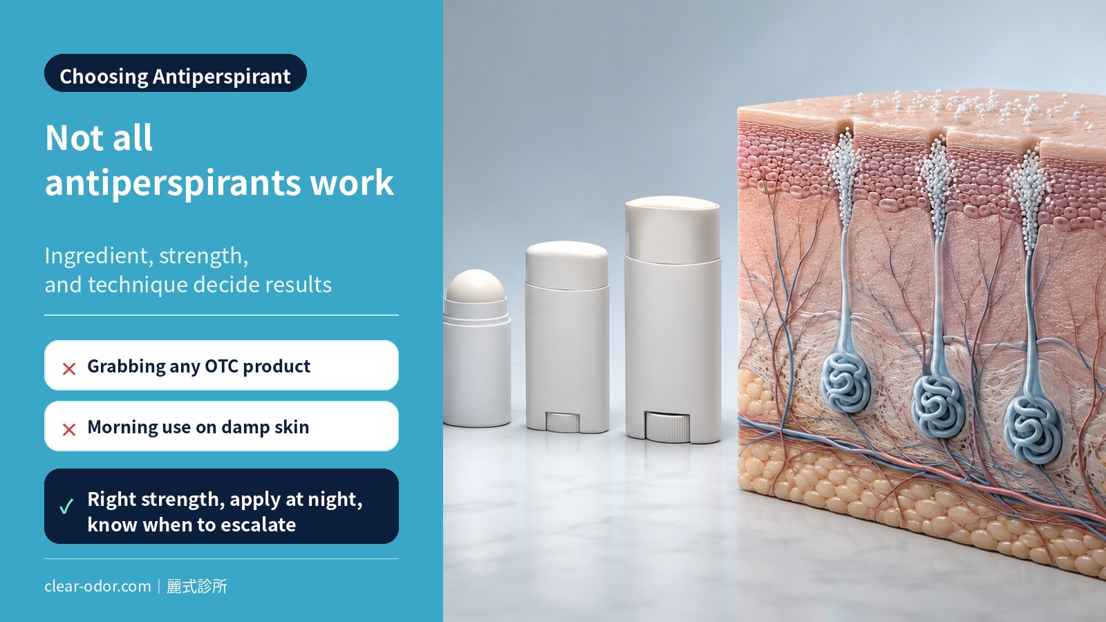 How to Choose the Right Antiperspirant: A Doctor's Guide to Ingredients, Strength, and When to Escalate