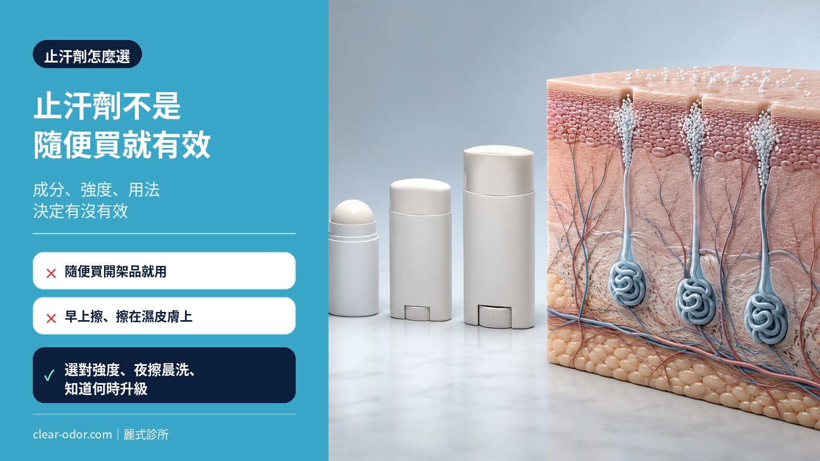 止汗劑怎麼選?醫師圖解成分、強度、正確用法與何時該升級療程