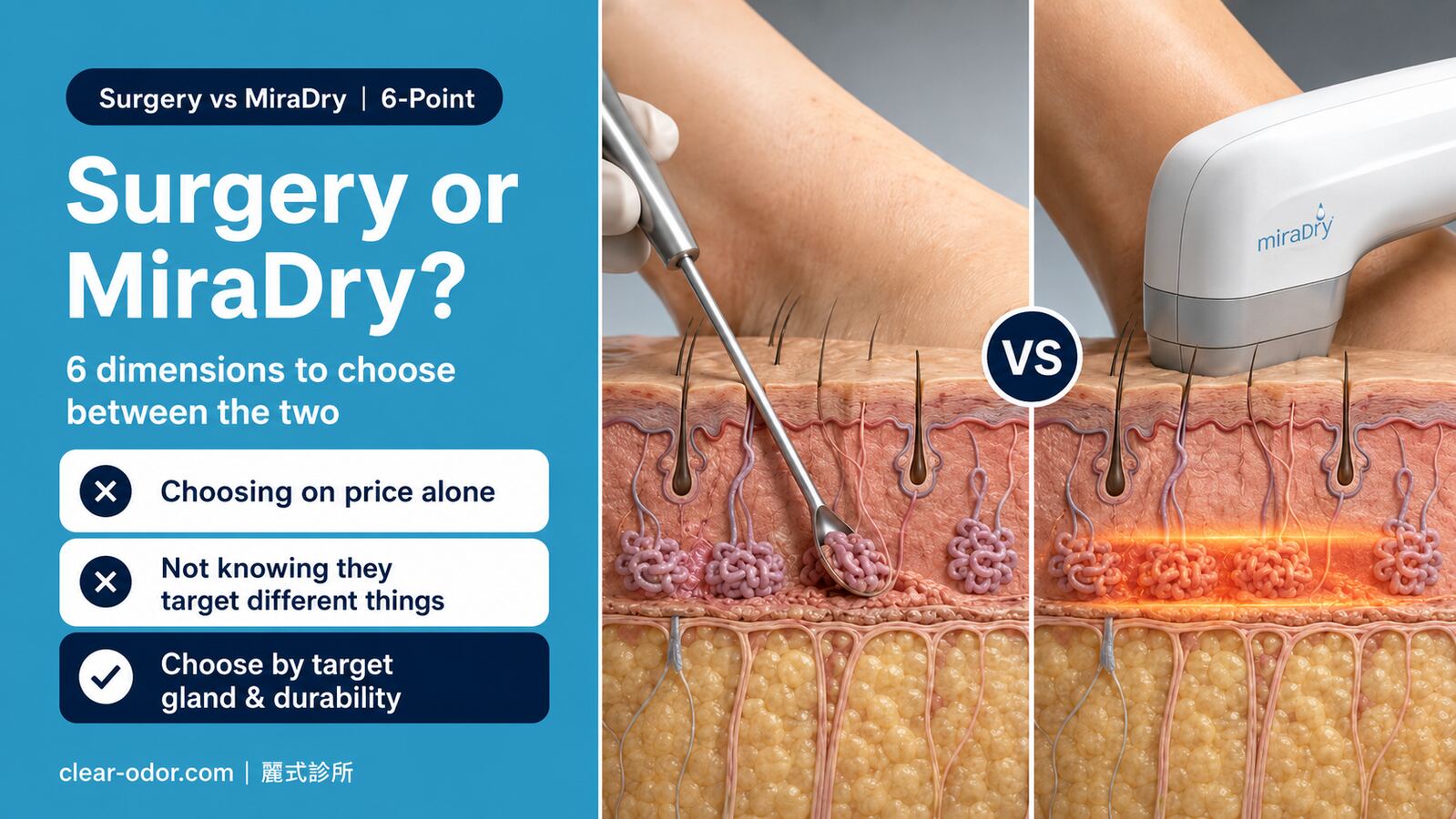 Bromhidrosis Surgery vs MiraDry: A 6-Point Comparison to Choose the Right Treatment