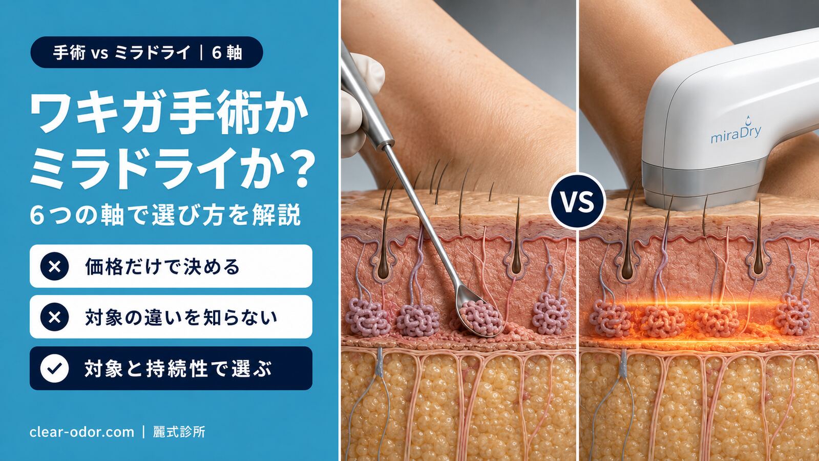 ワキガ手術とミラドライ、どっちを選ぶ?6つの違いを医師が徹底比較