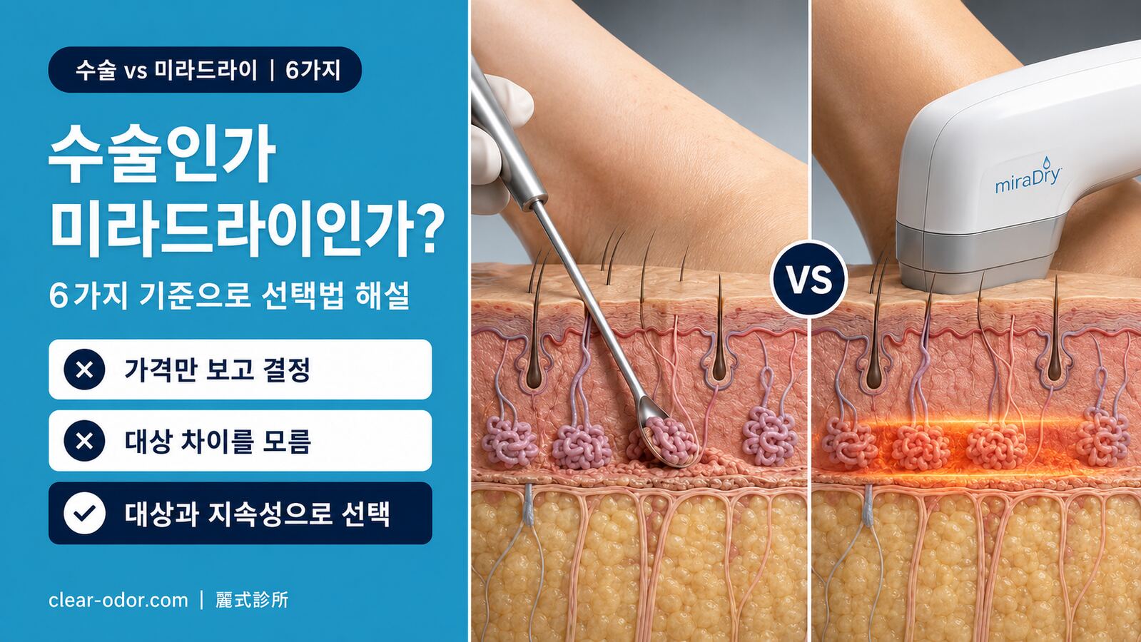 액취증 수술 vs 미라드라이, 어느 쪽? 6가지 차이를 의사가 비교