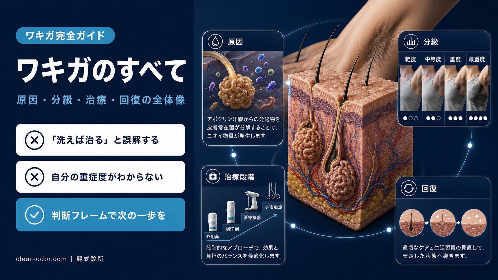 ワキガ完全ガイド:原因・診断・治療法の選択と術後経過(劉達儒 医師)