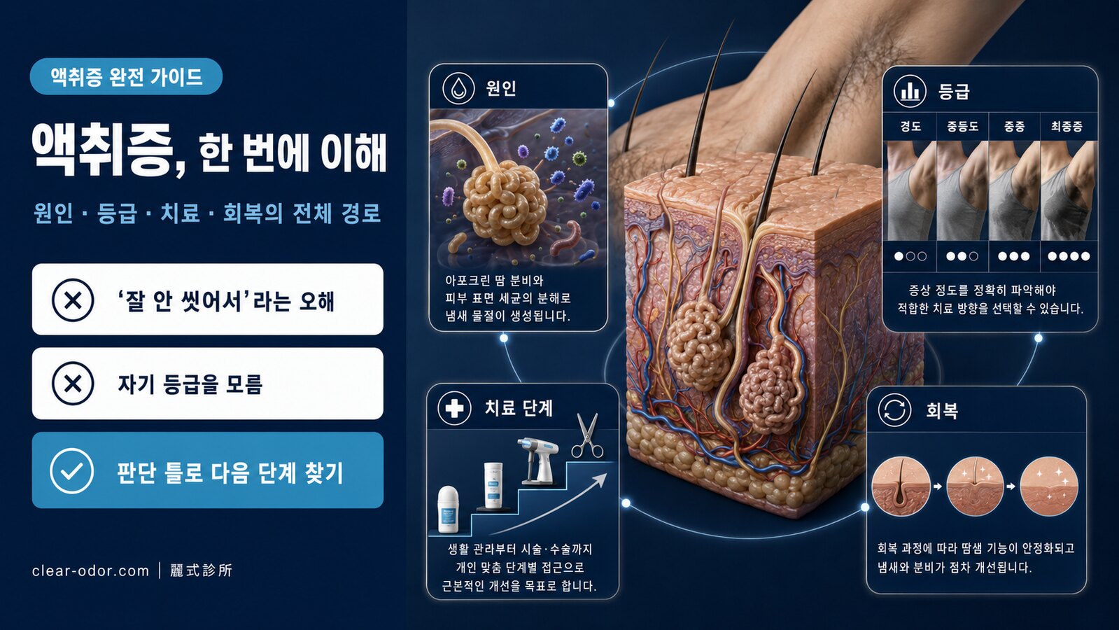 액취증 완전 가이드: 원인·진단·치료 선택·수술 후 회복 (유달유 원장)
