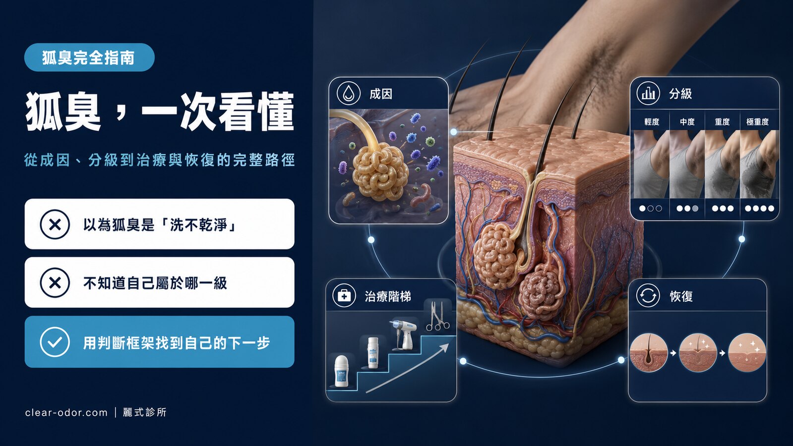 狐臭完全指南:劉達儒醫師談成因、診斷、治療方法選擇與術後恢復