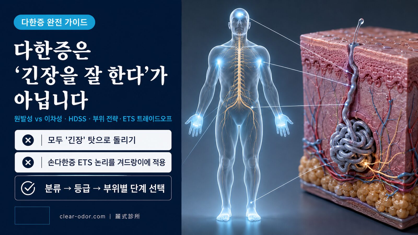 다한증 완전 가이드: 원발성 vs 이차성·HDSS 등급·치료 단계·ETS 트레이드오프 (유달유 원장)