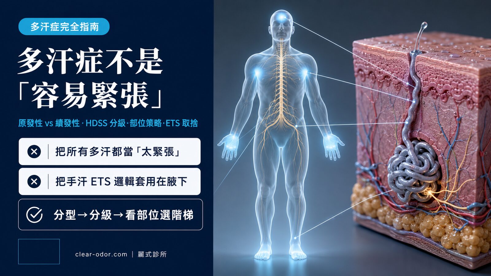 多汗症完全指南:劉達儒醫師談原發性與續發性、HDSS 分級、治療階梯與 ETS 取捨