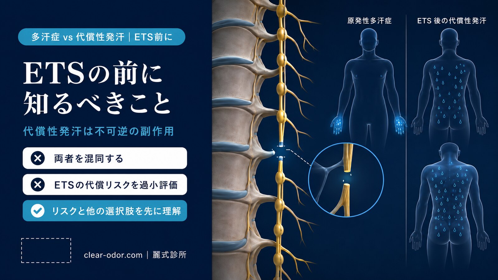 多汗症と代償性発汗の違い — ETS手術を受ける前に知っておくこと