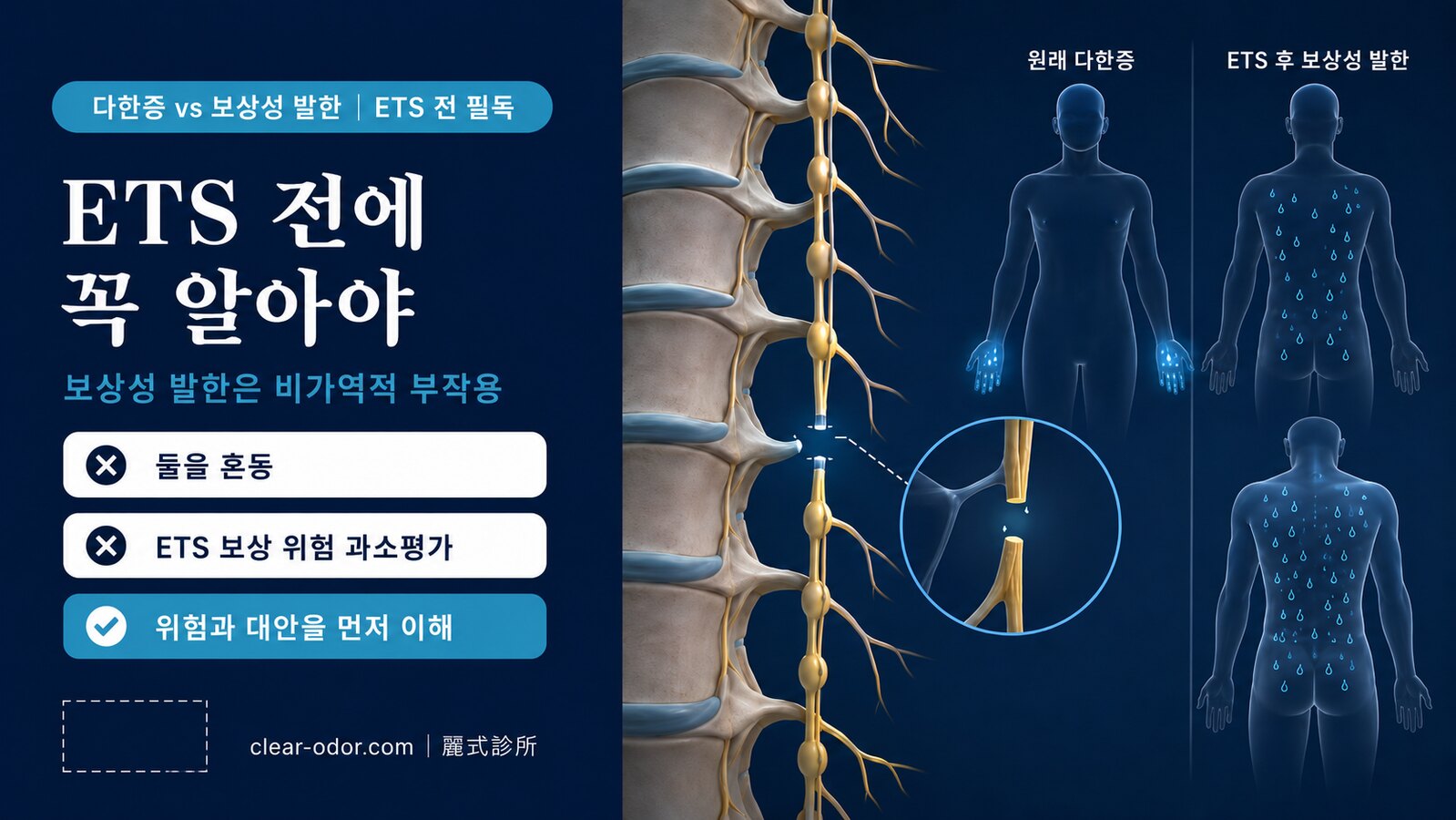다한증과 보상성 발한의 차이 — ETS 수술 전에 알아야 할 것