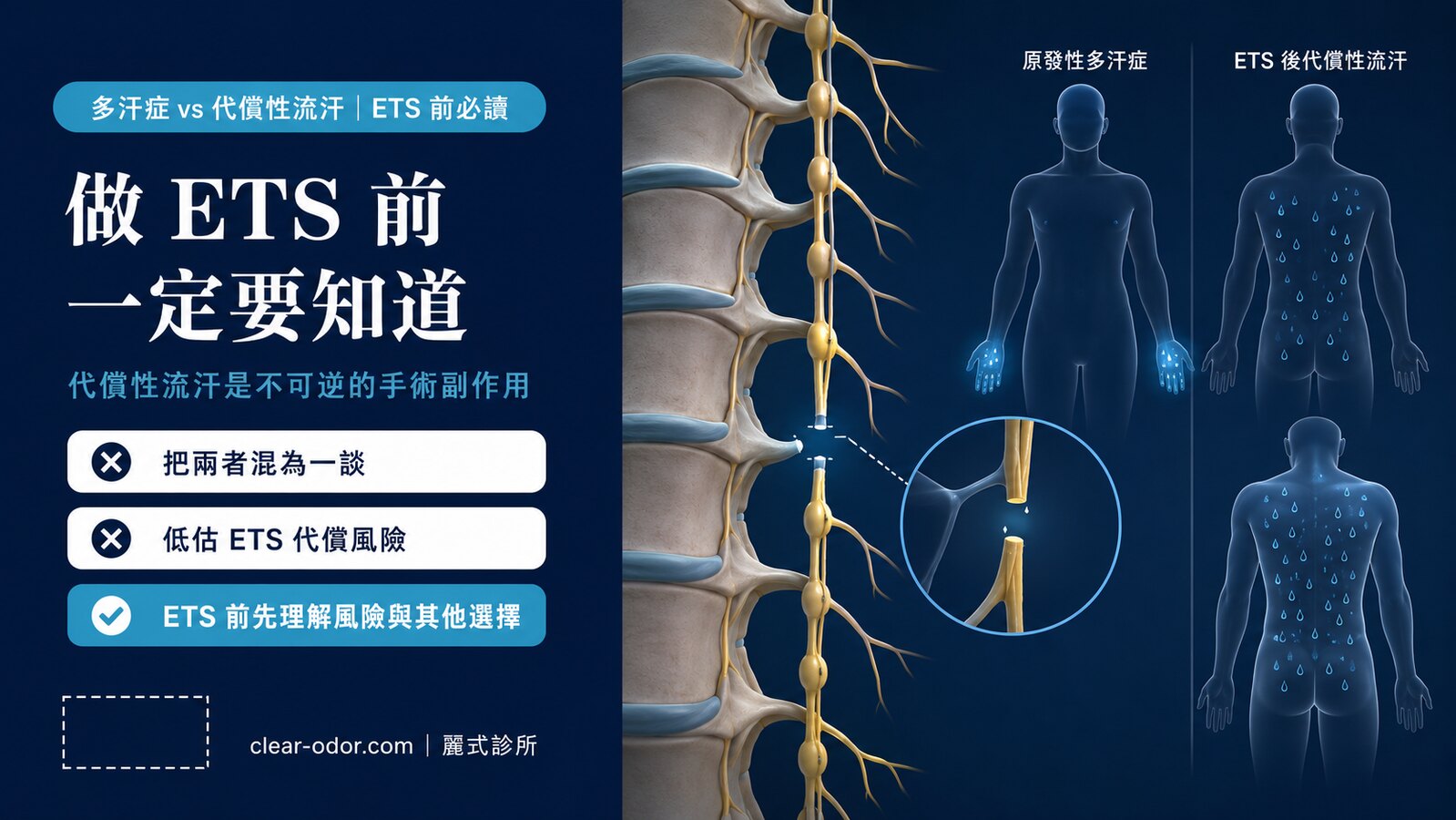 多汗症和代償性流汗差在哪?做 ETS 手術前一定要知道的事