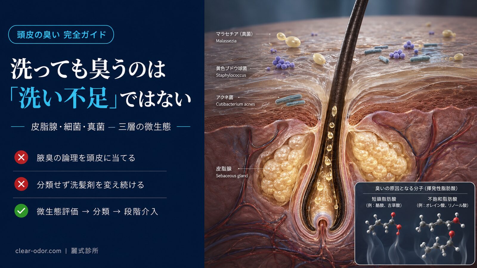 頭皮の臭い完全ガイド:劉達儒 医師が解き明かす「洗ってもまだ臭う」の微生態的真実と統合的対応プラン