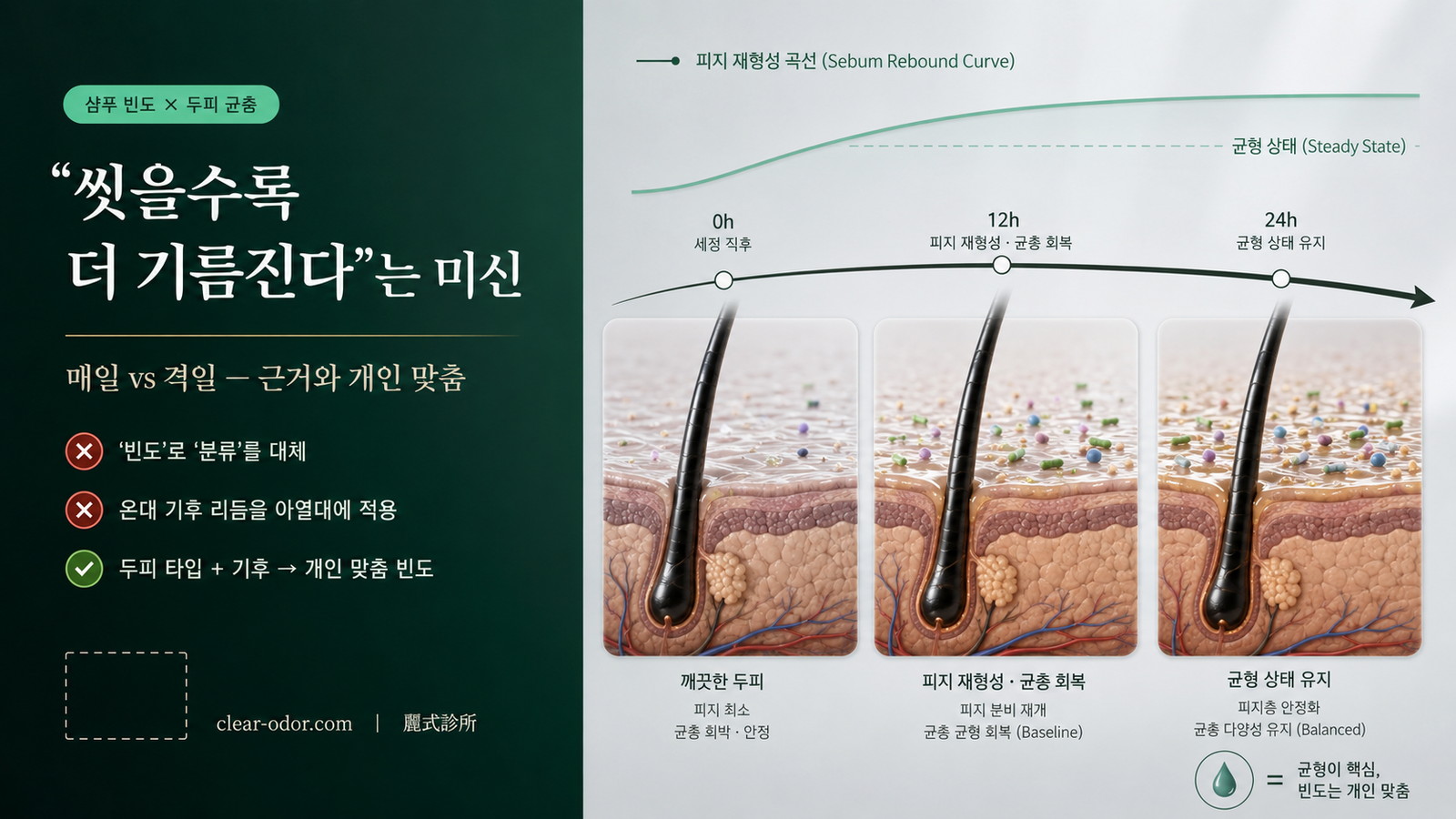 샴푸 빈도 × 두피 균총｜유달유 원장이 정리한 '매일 감기 vs 격일 감기'의 과학적 근거와 개인별 선택법