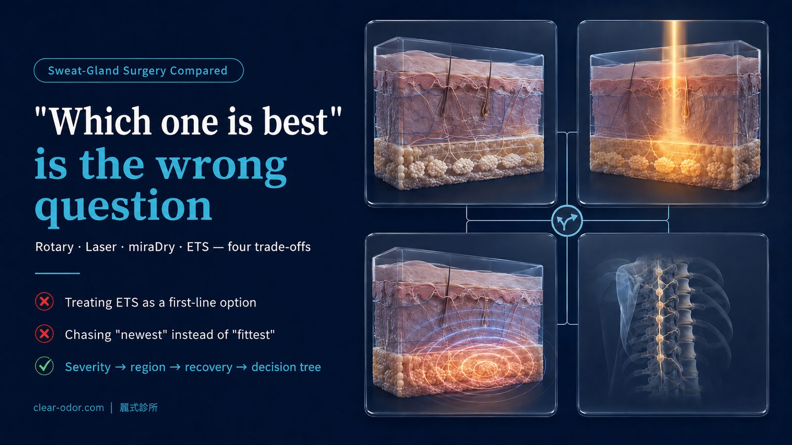 Sweat Gland Surgery Comparison: Rotational Curettage vs Laser vs miraDry vs ETS — Dr. Ta-Ju Liu Breaks Down 4 Main Techniques