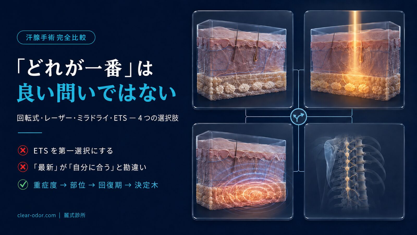 汗腺手術完全比較:ローテーション式キュレッタージ vs レーザー vs miraDry vs ETS — 劉達儒 医師による 4 つの主要術式の取捨選択