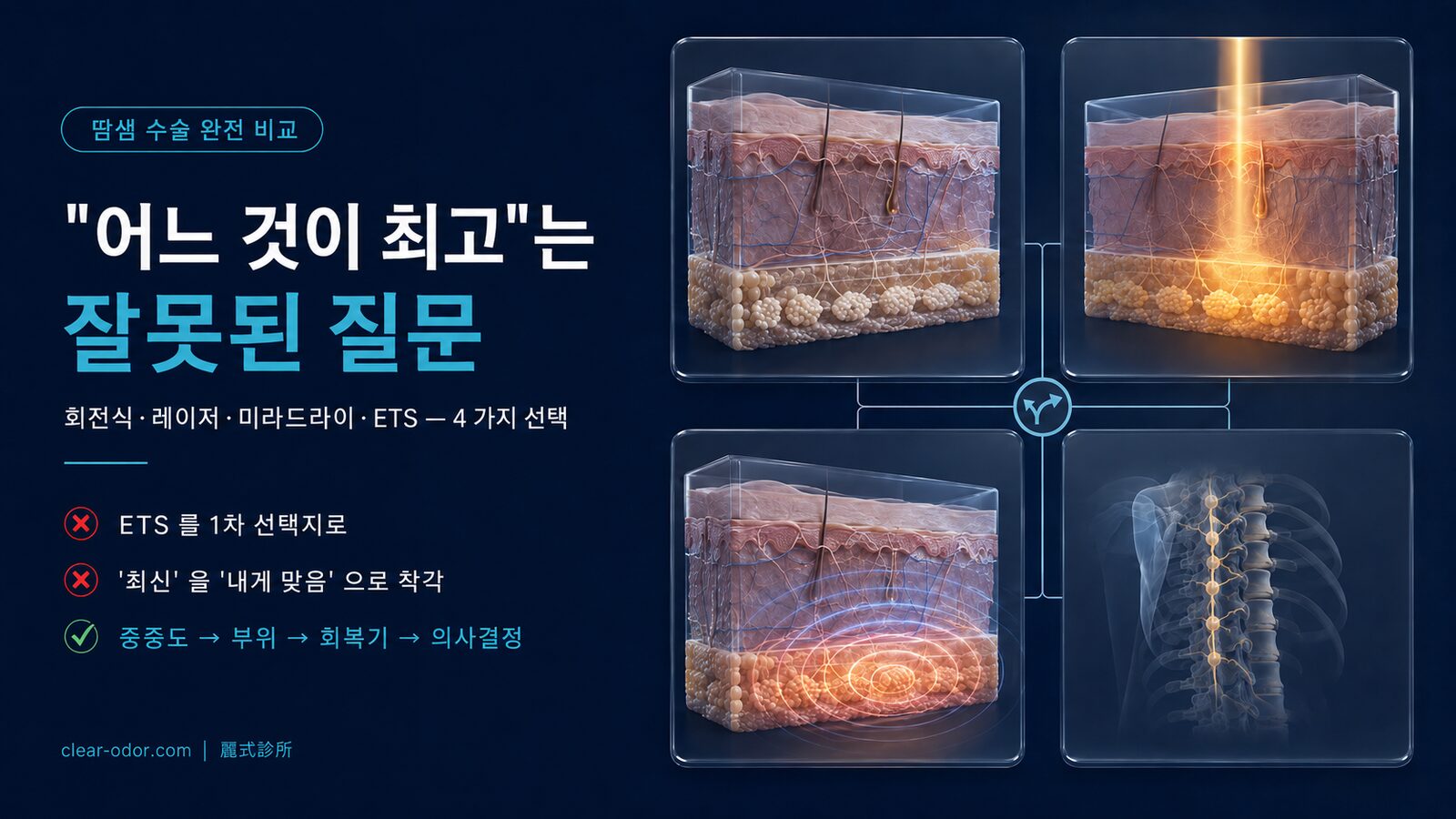 한선 수술 완전 비교: 회전식 큐레타지 vs 레이저 vs miraDry vs ETS — 유달유 원장이 분석하는 4가지 주류 기술의 트레이드오프