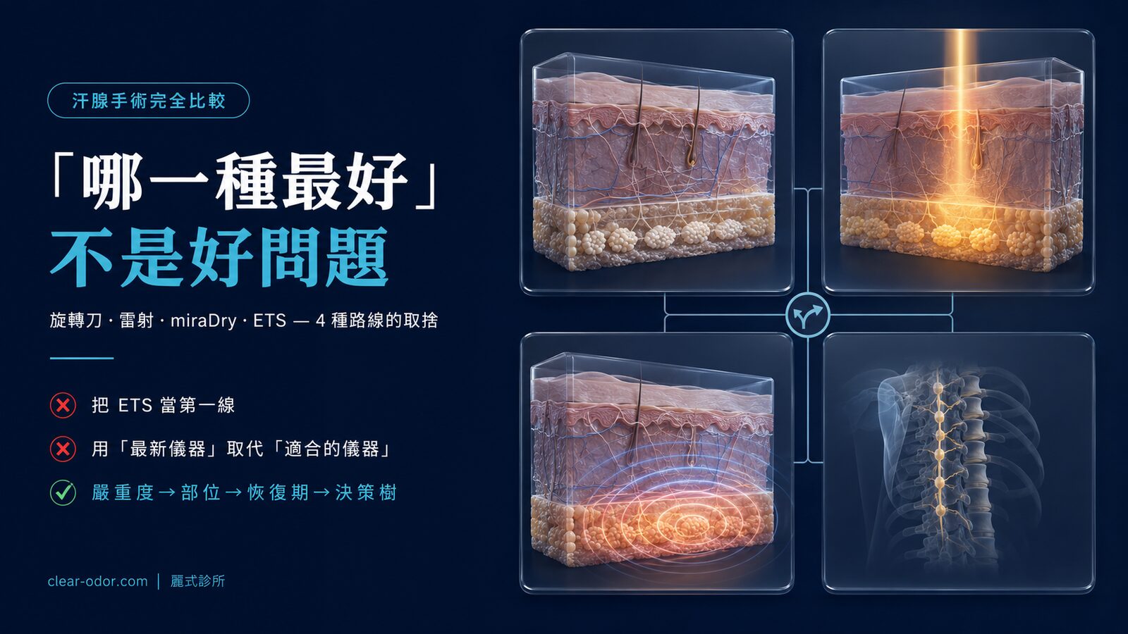 汗腺手術完全比較:旋轉刀 vs 雷射 vs miraDry vs ETS — 劉達儒醫師解析 4 種主流技術的取捨