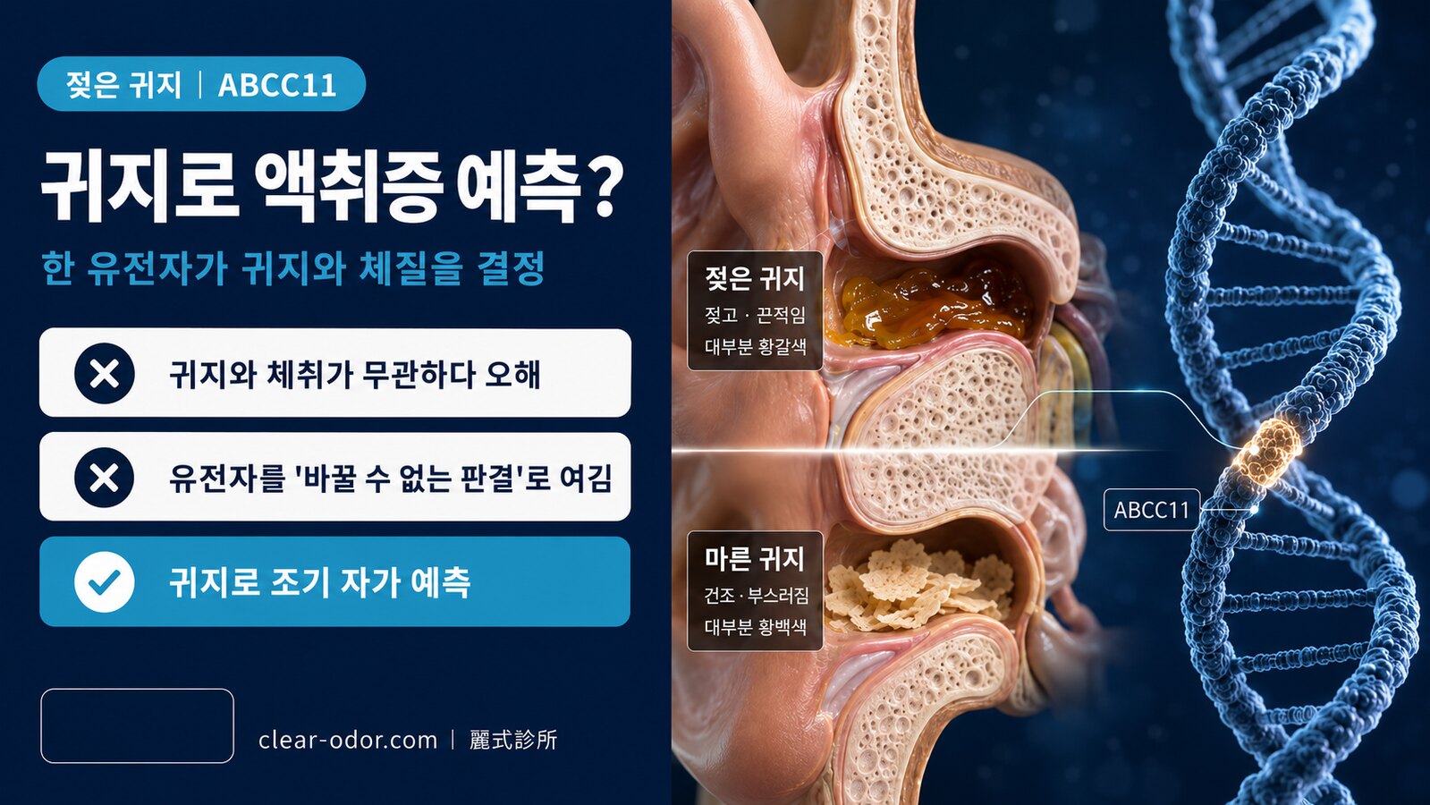 젖은 귀지와 액취증의 관계: ABCC11 유전자가 결정하는 체취 운명