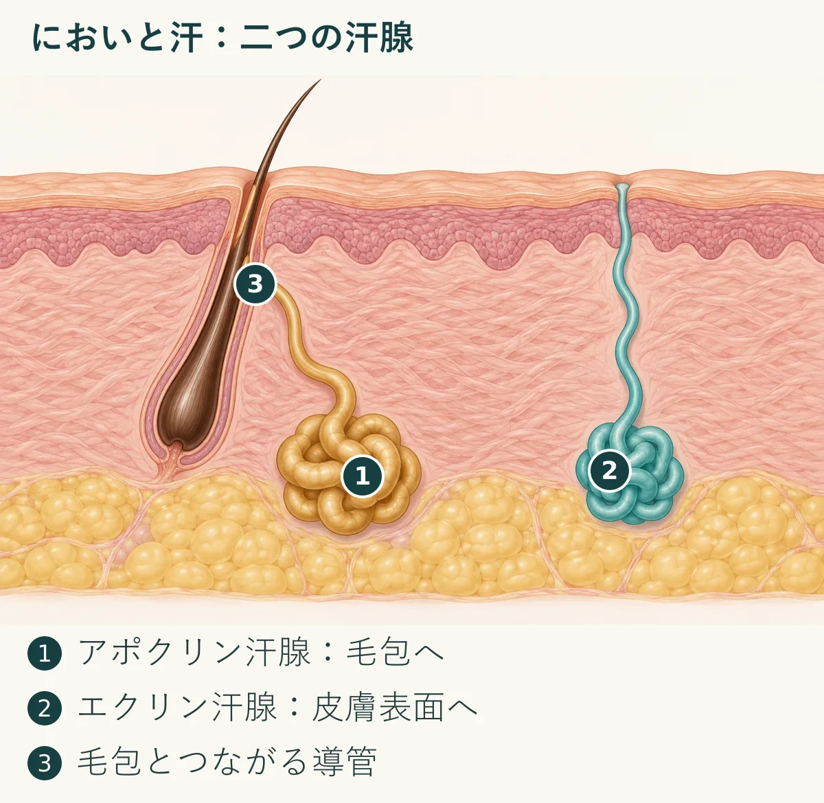においと汗:二つの汗腺。1. アポクリン汗腺:毛包へ;2. エクリン汗腺:皮膚表面へ;3. 毛包とつながる導管。左のアポクリン汗腺の分泌物は、皮膚の細菌に分解されるとにおいが生じます。右のエクリン汗腺は主に発汗と体温調節に関わり、両方の悩みが重なることもあります。 患者の写真ではなく医学的な模式図です。比率と色は簡略化しており、自己診断には使えません。